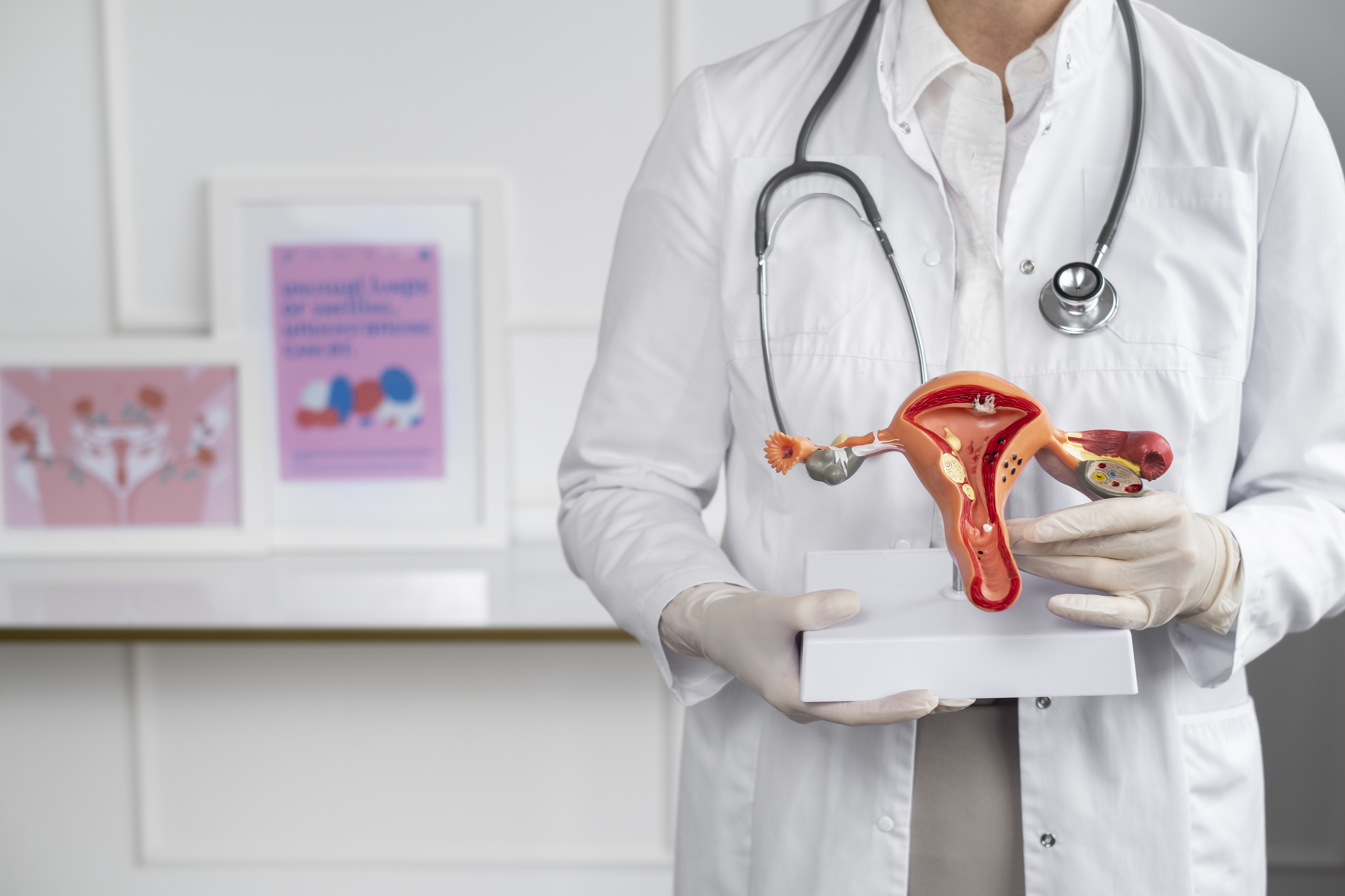 IUI (Intrauterine Insemination)